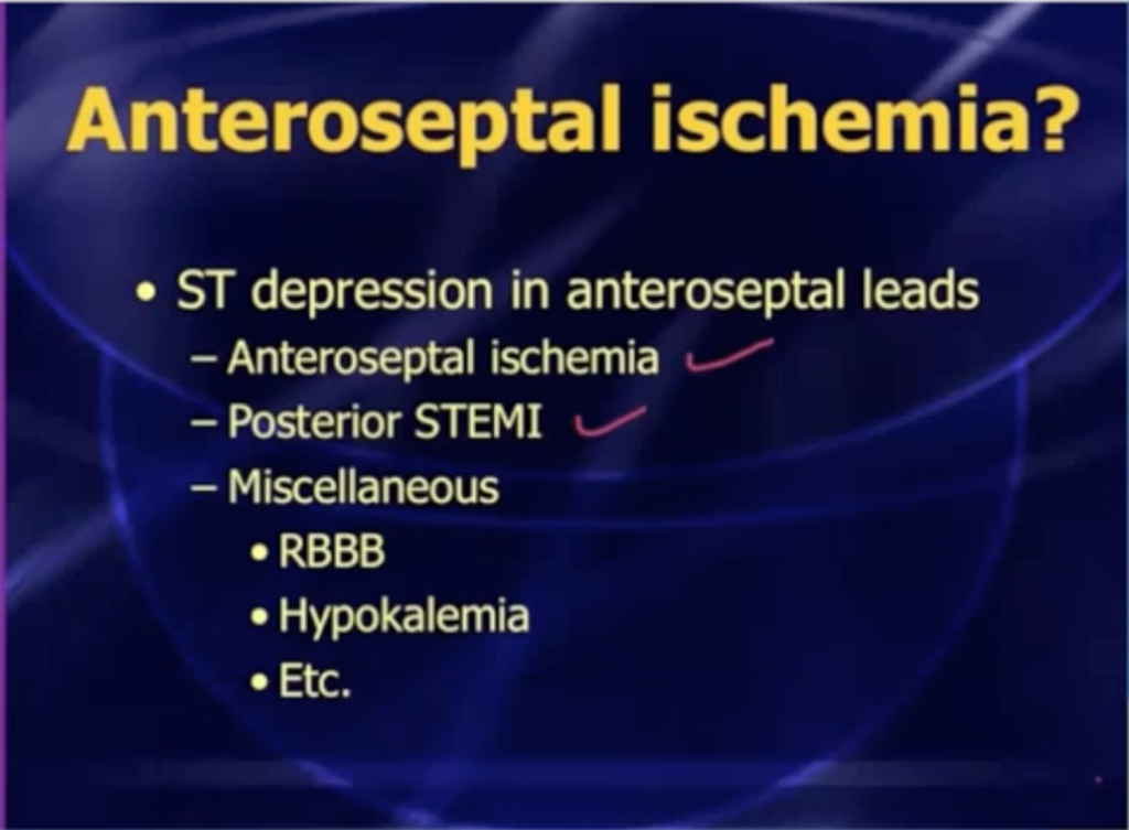 Mattu_Anteroseptal STD DDx