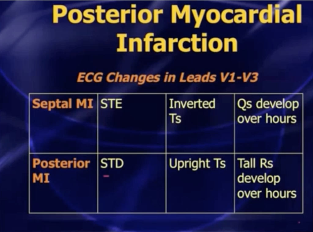 Posterior MI Septal MI DDx