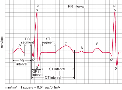 waves-of-the-ecg