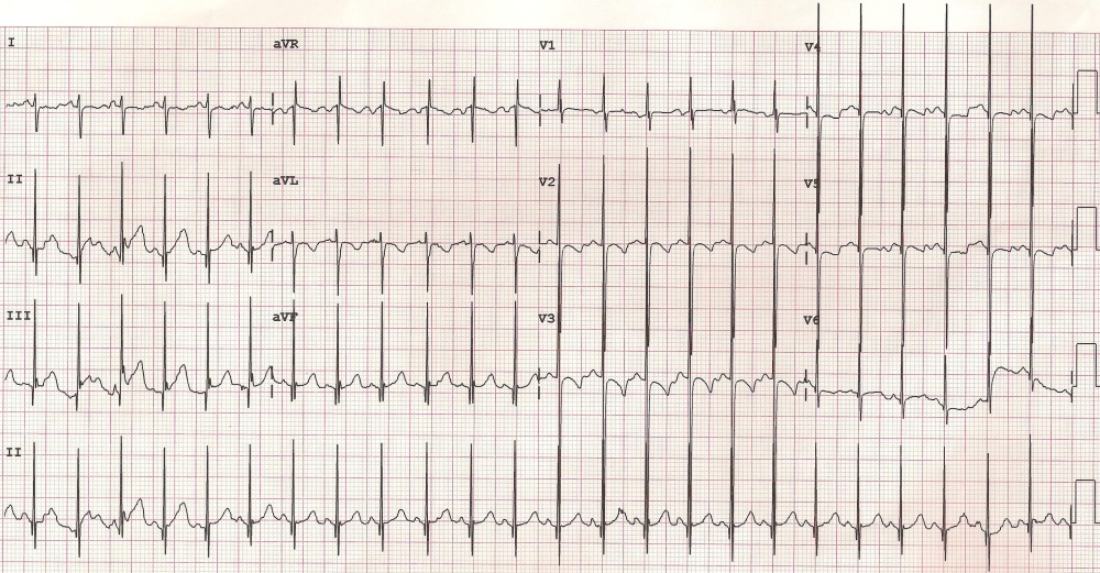 Johnson Francis for Cardiophile MD Kaynak için resmi tıklayınız.