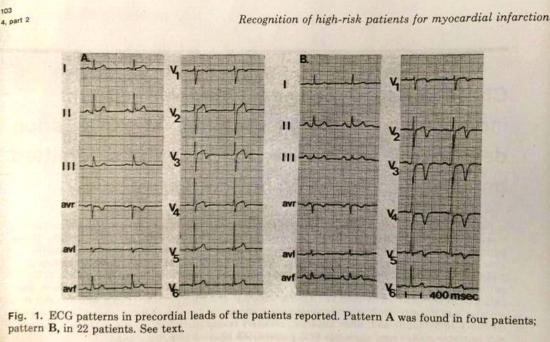 de Zwaan C, Bär FW, Wellens HJ orjinal sayfasından Wellens EKG patternleri sınıflandırması. Miyokard infarktı tehditi nedeniyle hastaneye yatırılmış hastalarda sol ön inen arterde kritik darlığa işaret eden karakteristik elektrokardiyografik pattern . Am Heart J. 1982 Apr;103(4 Pt 2):730-6.