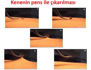 Şeil kaynağı: www.thsk.saglik.gov.tr