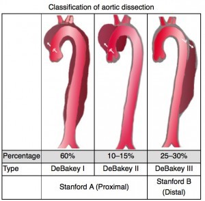 aortic-dissection-classification