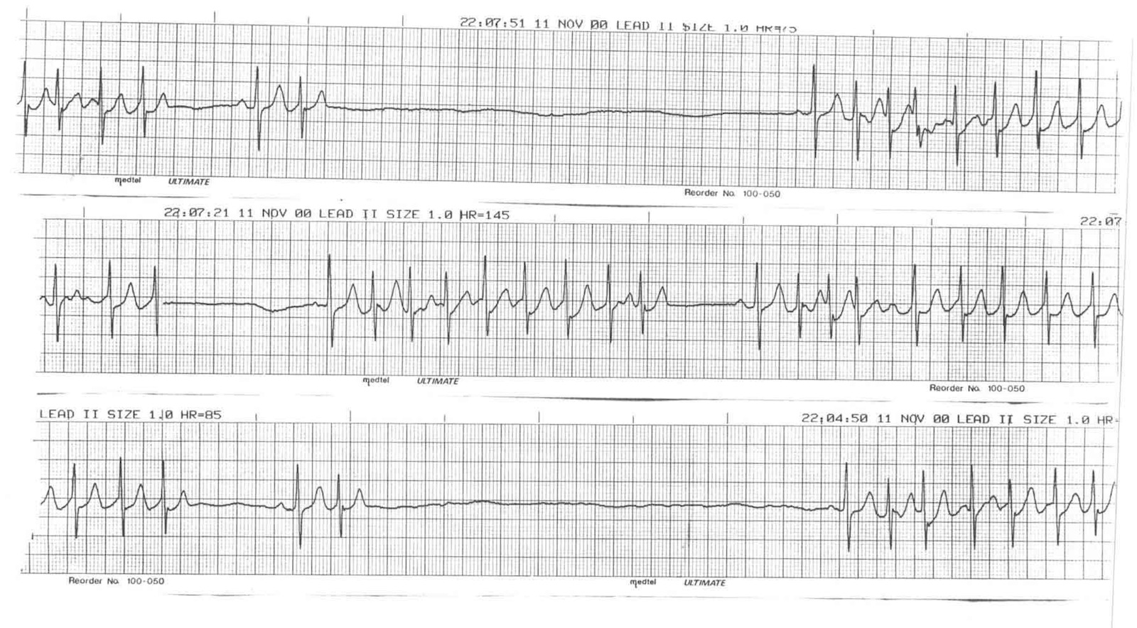Kaynak : lifeinthefastlane.com - ECG library