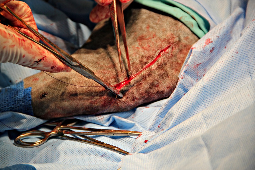 suture