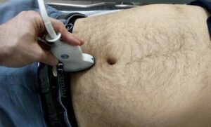 Temel Ultrasonografi - EFAST 14 Mesane longitudinal görüntüleme