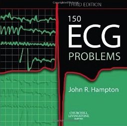 150 ecg problems