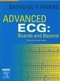 advanced ecg: boards and beyond
