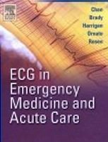 ECG in emergency medicine and acute care