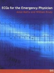 ecg emergency physician