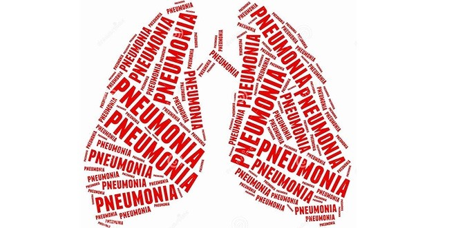 Pnömoni Tedavisinde Steroidlerin Yeri 1 Pnömoni Tedavisinde Steroidlerin Yeri 1