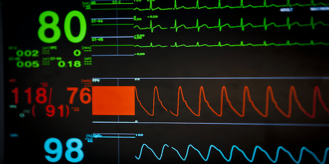 Normalleşen Vital Değerler Pulmoner Emboli Olasılığını Azaltır mı? 1