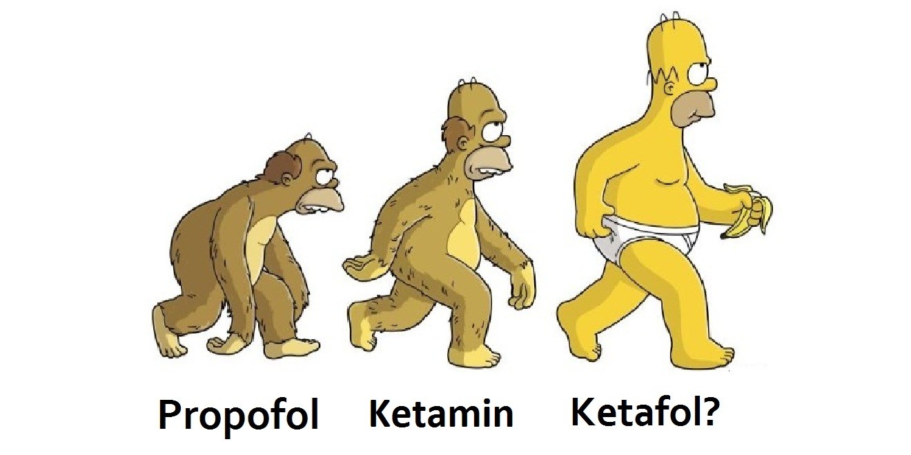 Ketafol: Prosedüral sedasyon ve aneljezide taşları yerinden oynatıyor mu? 1