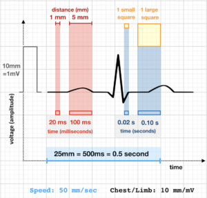 ECG RATE 50 mm sec ECG measurement RATE