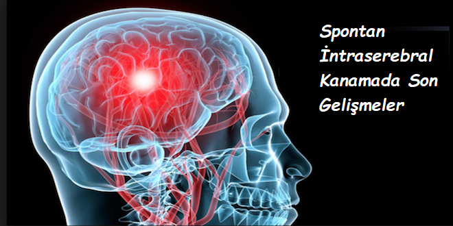 Spontan İntraserebral Kanamada Son Gelişmeler 1