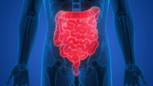 Akut Gastroenterit Tedavisi